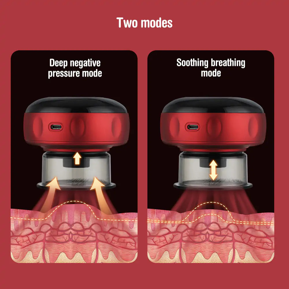 CuppingEase Pro- Remotable Cupping Massager